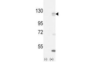 Western blot analysis of FGFR antibody and 293 cell lysate (2 ug/lane) either nontransfected (Lane 1) or transiently transfected with the FGFR1 gene (2). (FGFR1 antibody  (AA 132-161))