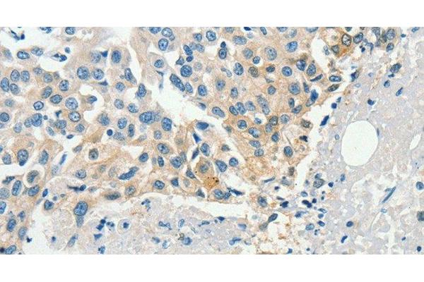 DGKB antibody