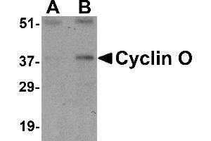 Western blot analysis of UNG2 in mouse bladder tissue lysate with UNG2 antibody at (A) 0. (Cyclin O antibody  (N-Term))