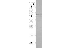 Western Blotting (WB) image for V-Raf Murine Sarcoma 3611 Viral Oncogene Homolog (ARAF) (AA 1-227) protein (His-IF2DI Tag) (ABIN7283968) (ARAF Protein (AA 1-227) (His-IF2DI Tag))