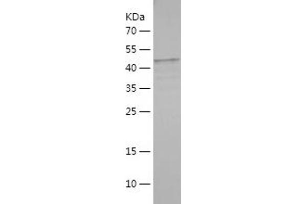 ARAF Protein (AA 1-227) (His-IF2DI Tag)