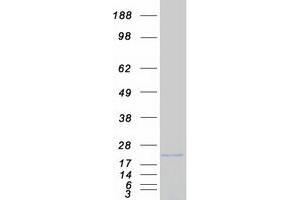 Validation with Western Blot (CYB5B Protein (Myc-DYKDDDDK Tag))