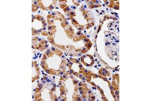 Immunohistochemical analysis of paraffin-embedded H. (Phosducin-Like antibody  (N-Term))