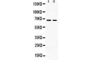 Western blot analysis of ACCN1 expression in rat testis extract ( Lane 1) and MCF-7 whole cell lysates ( Lane 2).
