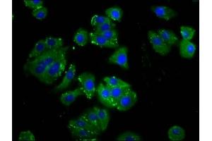 Immunofluorescence staining of HepG2 cells with ABIN7165895 at 1:133, counter-stained with DAPI. (ODR4 antibody  (AA 153-251))