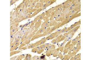 Immunohistochemistry of paraffin-embedded Rat heart using PEX5 Polyclonal Antibody at dilution of 1:100 (40x lens). (PEX5 antibody)