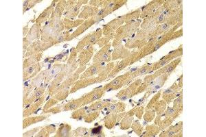 Immunohistochemistry of paraffin-embedded Rat heart using PEX5 Polyclonal Antibody at dilution of 1:100 (40x lens).