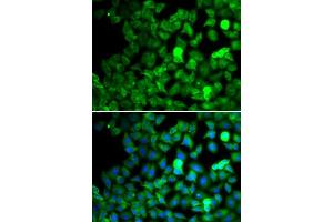 Immunofluorescence analysis of MCF-7 cells using SARS antibody. (Seryl-tRNA Synthetase (SARS) (AA 1-300) antibody)