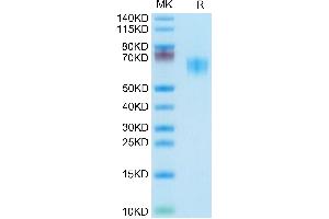 SDS-PAGE (SDS) image for CD28 (CD28) (AA 19-152) protein (mFc Tag) (ABIN7274254)