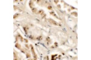 Immunohistochemistry of GZF1 in human kidney tissue with GZF1/ZNF336 Antibody at 2. (ZNF336 antibody  (C-Term))