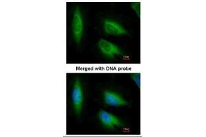 ICC/IF Image Immunofluorescence analysis of paraformaldehyde-fixed HeLa, using EEF1E1, antibody at 1:200 dilution. (EEF1E1 antibody)