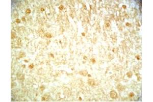 Mouse brain tissue was stained by Rabbit Anti-Metasin (1-25) (Human) / KISS-1 (68-92) (Human) Serum (KISS1 antibody  (AA 1-25, AA 68-92))
