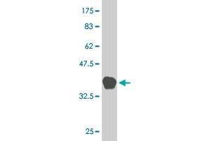 Western Blot detection against Immunogen (38. (MAP2K5 antibody  (AA 1-120))