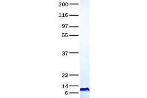 Validation with Western Blot (CCL3L1 Protein)