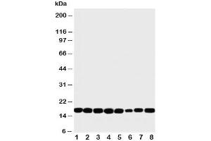 Western blot testing of NM23 antibody and rat samples 1: heart;  2: brain;  3: liver;  4: skeletal muscle; and human samples 5: PANC;  6: HeLa;  7: SKOV;  8: COLO320 cell lysate
