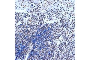 Immunohistochemistry of paraffin-embedded human appendix using A Rabbit mAb (ABIN7265387) at dilution of 1:100 (40x lens). (BAF53A antibody)