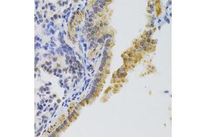 Immunohistochemistry of paraffin-embedded mouse lung using KIF1B Antibody. (KIF1B antibody  (AA 1501-1770))