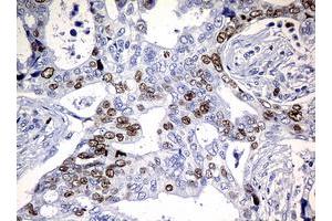 Image no. 5 for anti-Antigen Identified By Monoclonal Antibody Ki-67 (MKI67) (AA 1160-1493) antibody (ABIN1490857) (Ki-67 antibody  (AA 1160-1493))