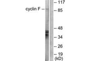 Western blot analysis of extracts from HeLa cells, using Cyclin F Antibody.