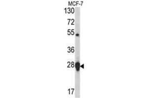 Western blot analysis of HSP27 antibody (Center) in MCF-7 cell line lysates (35ug/lane). (HSP27 antibody  (Middle Region))