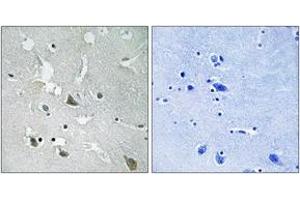 Immunohistochemistry analysis of paraffin-embedded human brain, using TIRAP (Phospho-Tyr86) Antibody. (TIRAP antibody  (pTyr86))
