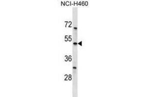 Western Blotting (WB) image for anti-Potassium Channel, Subfamily K, Member 12 (KCNK12) antibody (ABIN3000027)
