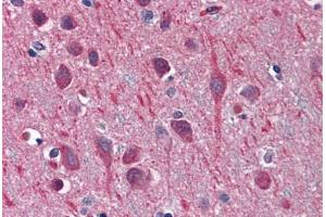 anti-Tubulin, beta 2A (TUBB2A) (AA 1-446) antibody