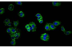 Immunofluorescence staining of HepG2 cells with ABIN7144938 at 1:166, counter-stained with DAPI. (ABCG5 antibody  (AA 1-127))