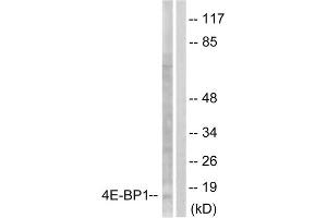 Western blot analysis of extracts from Jurkat cells, treated with Insulin (0. (eIF4EBP1 antibody  (Ser65))