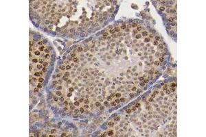 Immunohistochemistry analysis of paraffin-embedded mouse testis using CNOT8 (ABIN7073363) at dilution of 1: 800 (CNOT8 antibody)