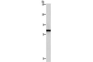 Western Blotting (WB) image for anti-Thyroid Hormone Receptor Interactor 4 (TRIP4) antibody (ABIN2429537) (TRIP4 antibody)