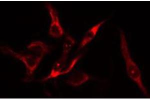 ABIN6274177 staining HuvEc cells by IF/ICC. (PFKFB1 antibody  (C-Term))
