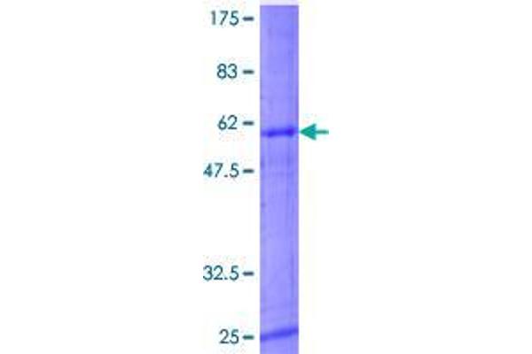 ASB11 Protein (GST tag)