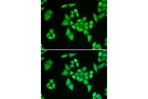 Immunofluorescence analysis of HeLa cells using ADSL antibody. (Adenylosuccinate Lyase antibody)