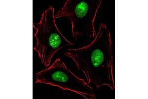 Fluorescent image of Hela cells stained with XAF1 PTK2B Antibody (C-term) (ABIN6243517 and ABIN6577462). (PTK2B antibody  (C-Term))