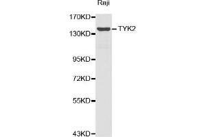 Western blot analysis of extracts of Raji cell lines, using TYK2 antibody. (TYK2 antibody  (AA 750-850))