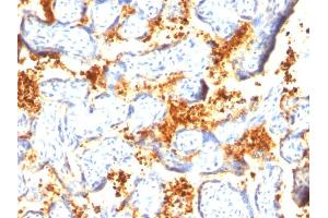 Formalin-fixed, paraffin-embedded human Placenta stained with Transglutaminase II Mouse Monoclonal Antibody (SPM358). (Transglutaminase 2 antibody)