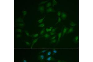 Immunofluorescence analysis of MCF-7 cells using LIG1 Polyclonal Antibody (LIG1 antibody)