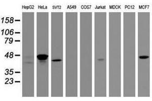 Image no. 2 for anti-Chromobox Homolog 8 (CBX8) (AA 1-260) antibody (ABIN1490666) (CBX8 antibody  (AA 1-260))