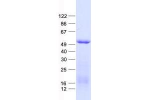 Validation with Western Blot (GCM1 Protein (His tag))