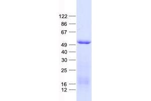 GCM1 Protein (His tag)