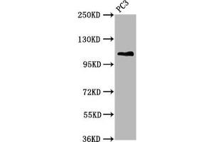 Western Blot Positive WB detected in: PC-3 whole cell lysate All lanes: FAN1 antibody at 5. (FAN1 antibody  (AA 167-373))