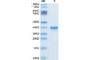 Human TGF-alpha on Tris-Bis PAGE under reduced condition. (TGFA Protein (AA 40-89) (Fc Tag))