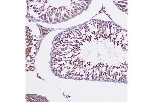Immunohistochemistry of paraffin-embedded Rat testis using TUBGCP6 Rabbit pAb (ABIN7271055) at dilution of 1:100 (20x lens). (GCP6 antibody  (AA 600-900))