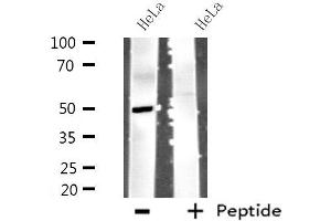 Western blot analysis of extracts from HeLa cells using MYLIP antibody. (MYLIP antibody  (Internal Region))