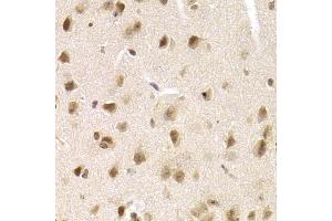 Immunohistochemistry of paraffin-embedded mouse brain using MCM4 Antibody (ABIN5971548) at dilution of 1/200 (40x lens). (MCM4 antibody)