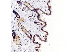 Immunohistochemistry of paraffin embedded mouse skin using Palladin (ABIN7074976) at dilution of 1: 1000 (200x lens)