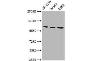 Western Blot Positive WB detected in: SH-SY5Y whole cell lysate, HepG2 whole cell lysate, K562 whole cell lysate All lanes: ULK2 antibody at 2. (ULK2 antibody  (AA 211-276))