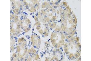 Immunohistochemistry of paraffin-embedded Human stomach using GPT Polyclonal Antibody at dilution of 1:100 (40x lens). (ALT antibody)
