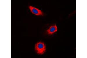 Immunofluorescent analysis of Aldose Reductase staining in Jurkat cells. (AKR1B1 antibody  (C-Term))